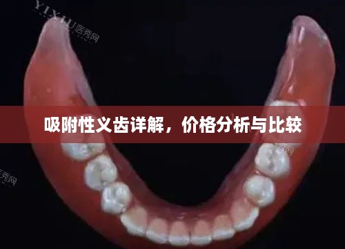 吸附性义齿详解，价格分析与比较